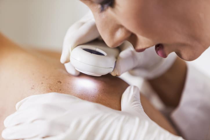 A dermatologist examining a patient's skin with a dermatoscope