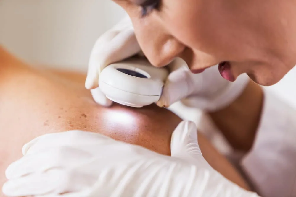 Dermatologist examining patient’s skin lesion with handheld device for diagnosis