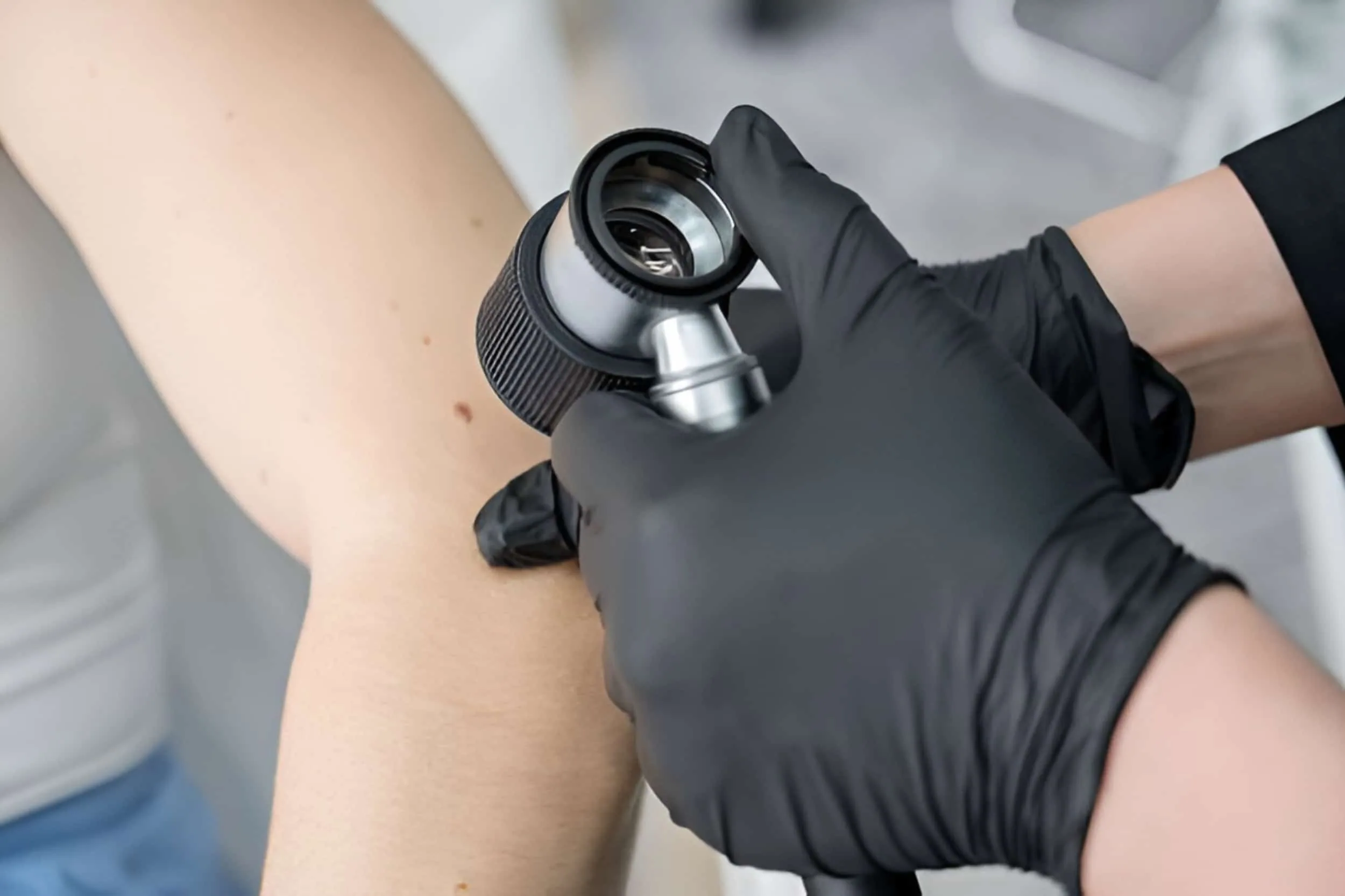 The Importance of Insurance Verification in Dermatology Offices