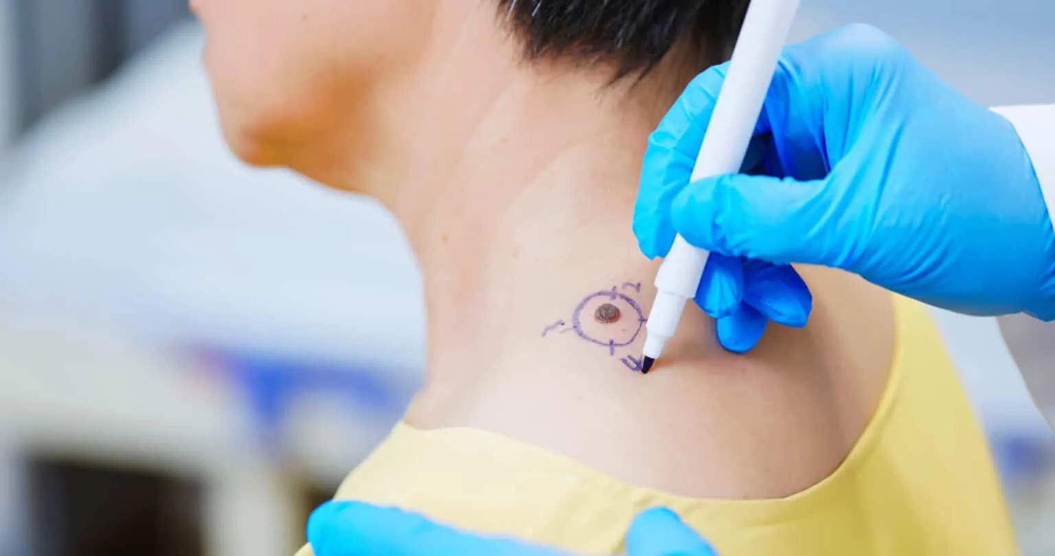 Understanding Modifiers in Dermatology Billing